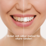 Tandblekning SuperBright+ - Bild 3